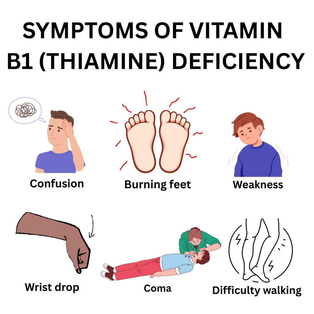 vitamin b1 (thiamine) deficiency symptoms
