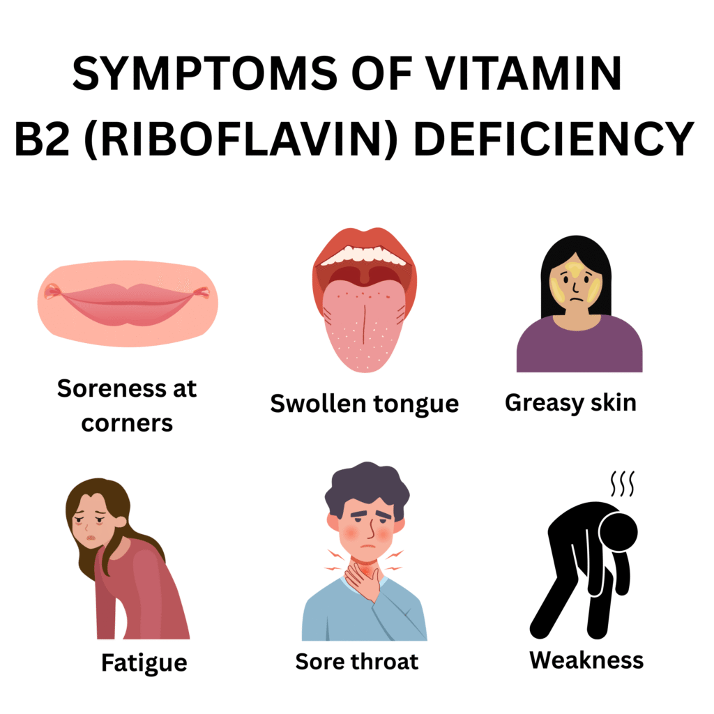 vitamin b2 deficiency symptoms